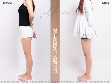 萊波亞 