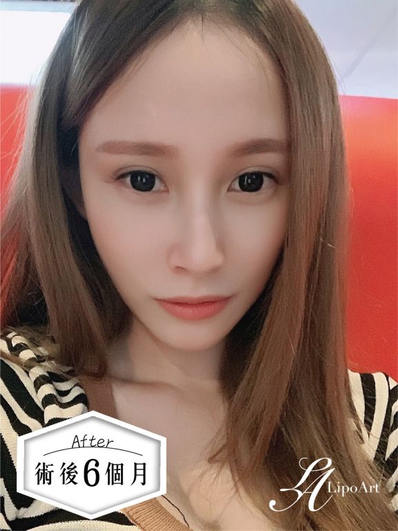 萊波亞