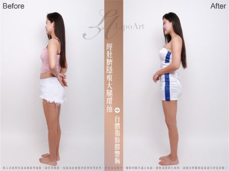 萊波亞 