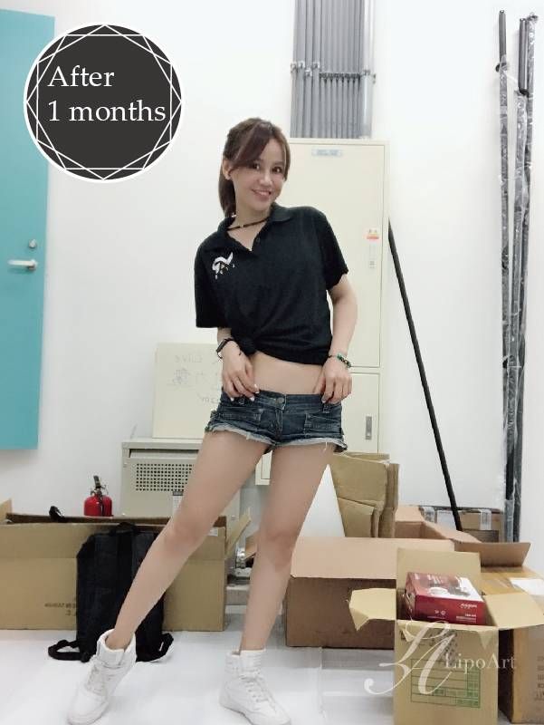萊波亞