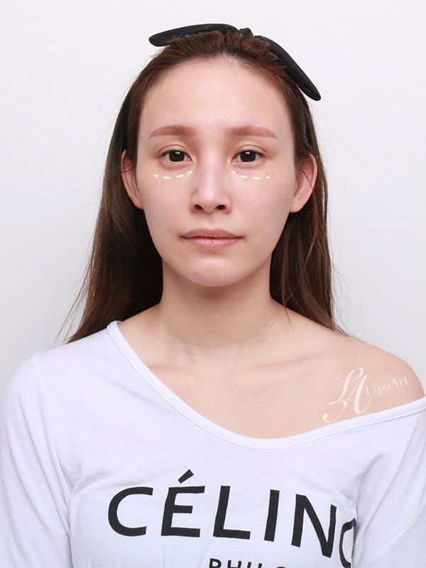 萊波亞
