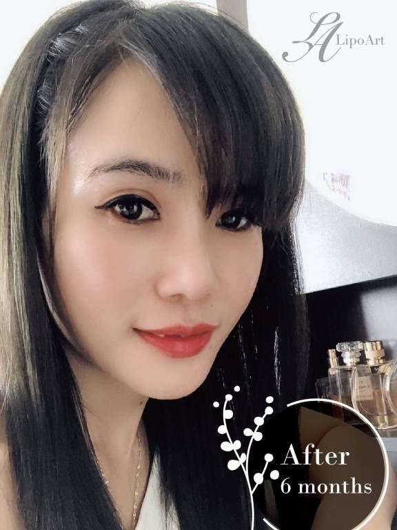 萊波亞