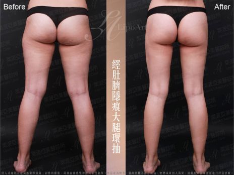 萊波亞 