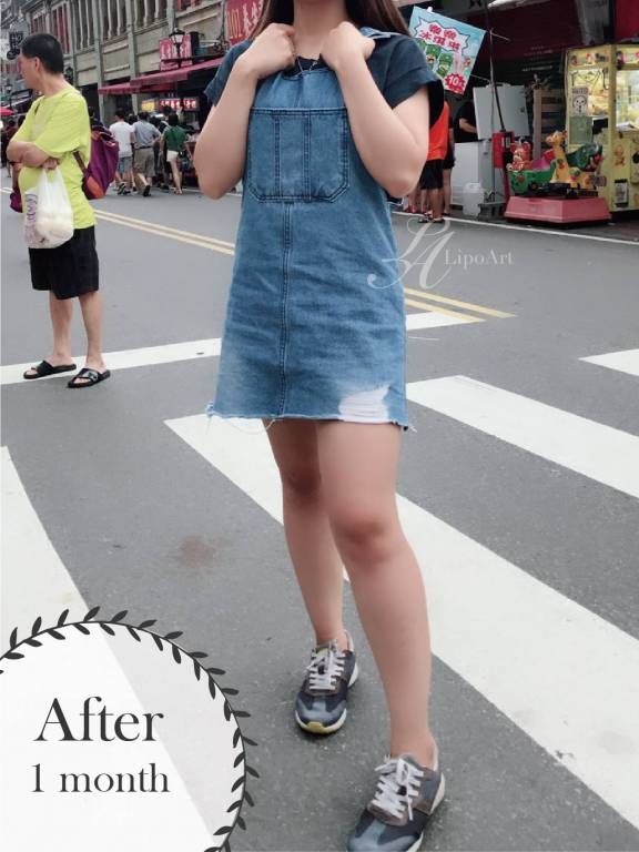 萊波亞