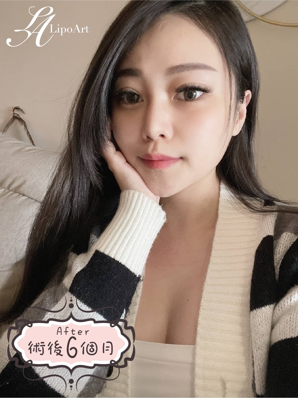 萊波亞