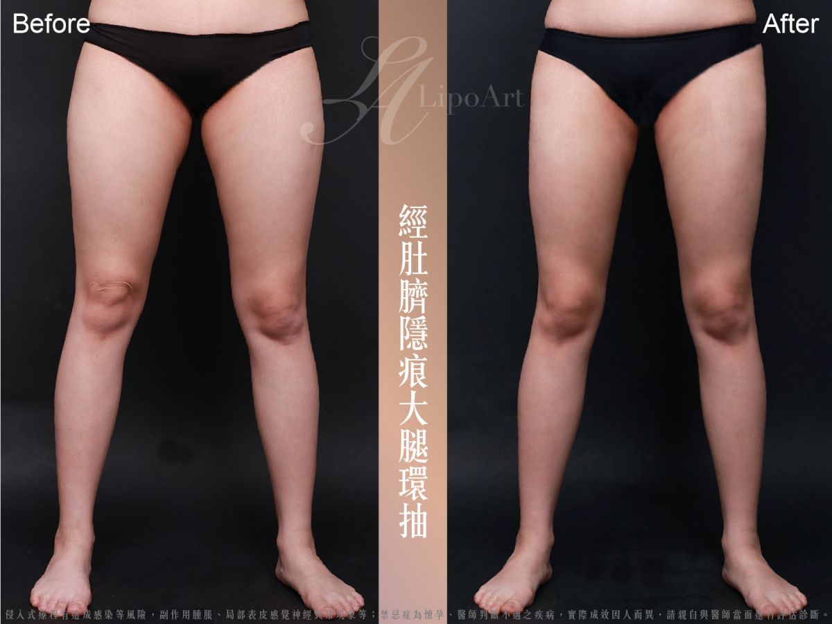 萊波亞