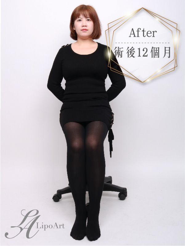 萊波亞