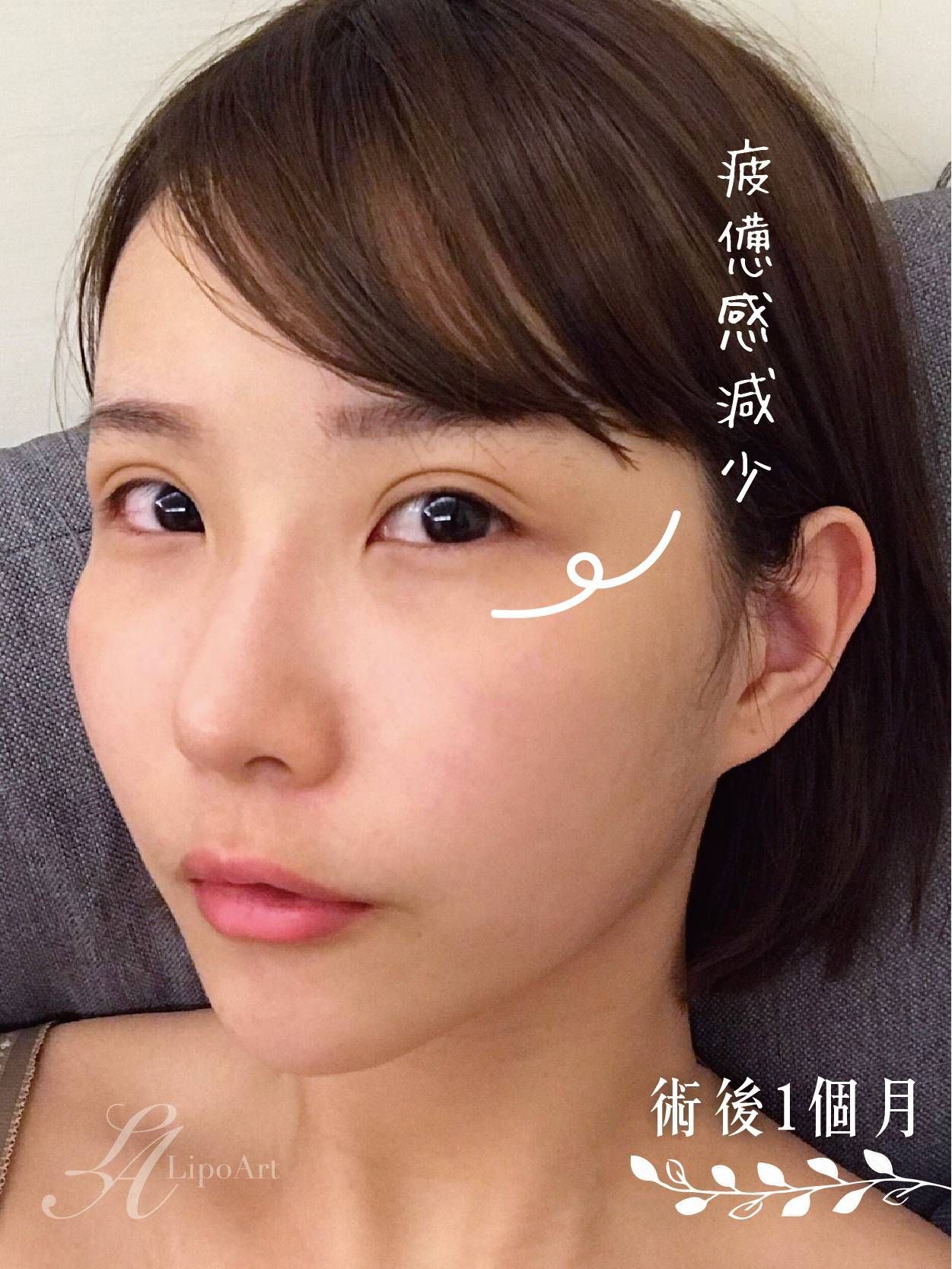 萊波亞