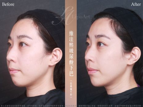 萊波亞