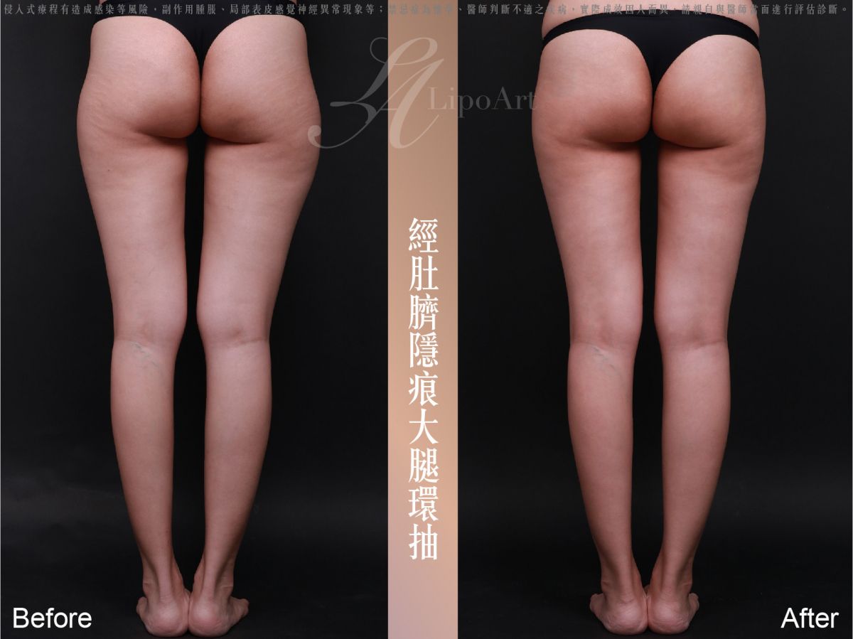 萊波亞