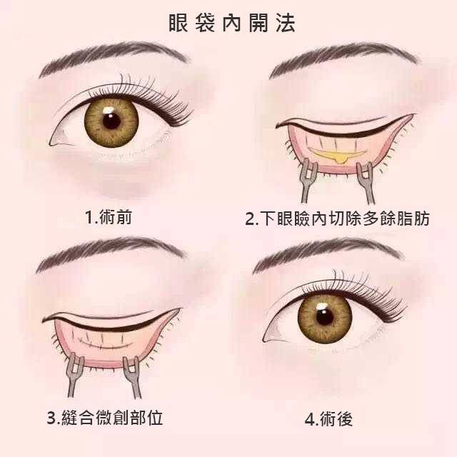 萊波亞