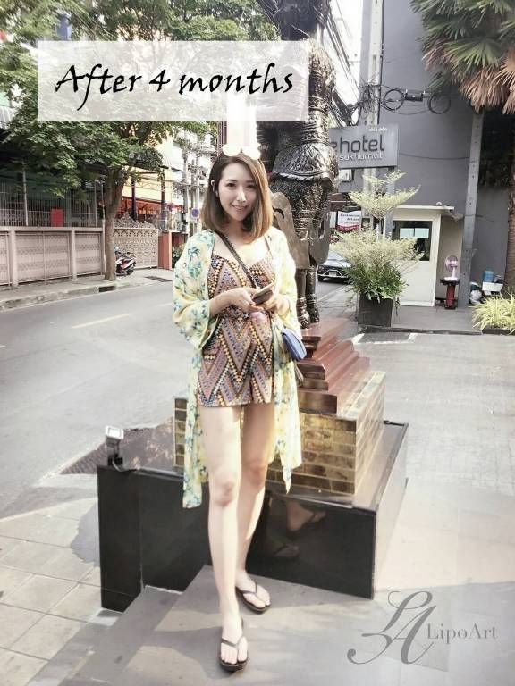萊波亞