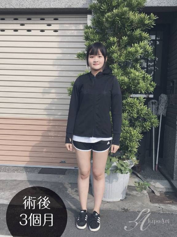 萊波亞