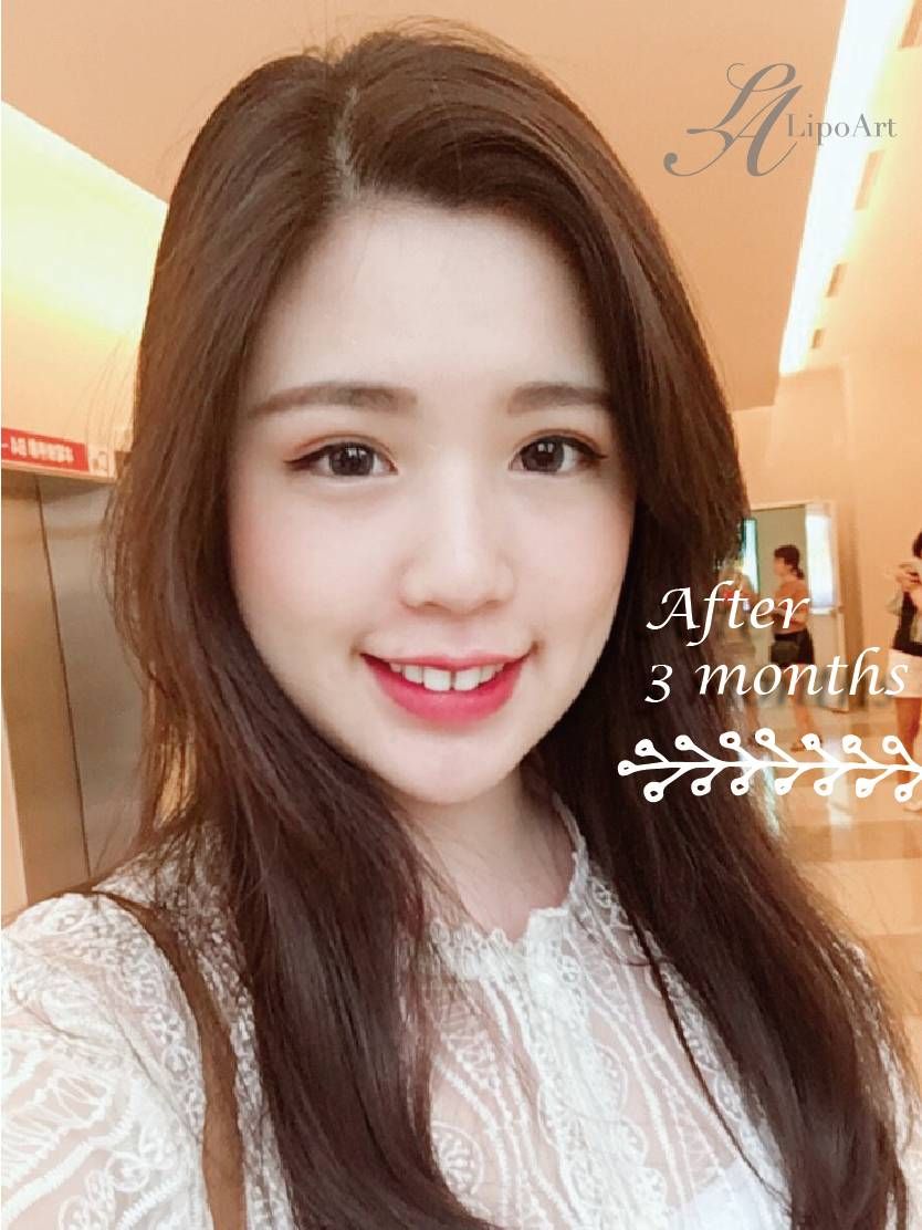萊波亞