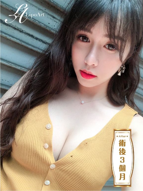 萊波亞