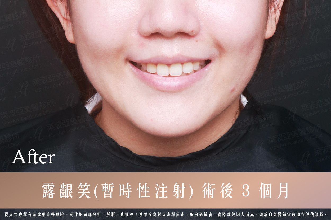 萊波亞