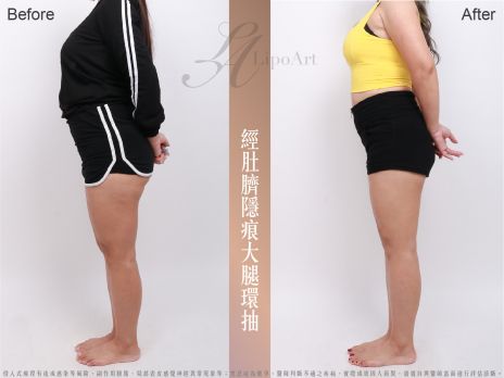 萊波亞 