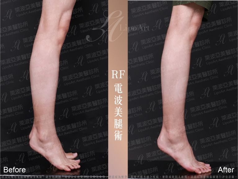 萊波亞