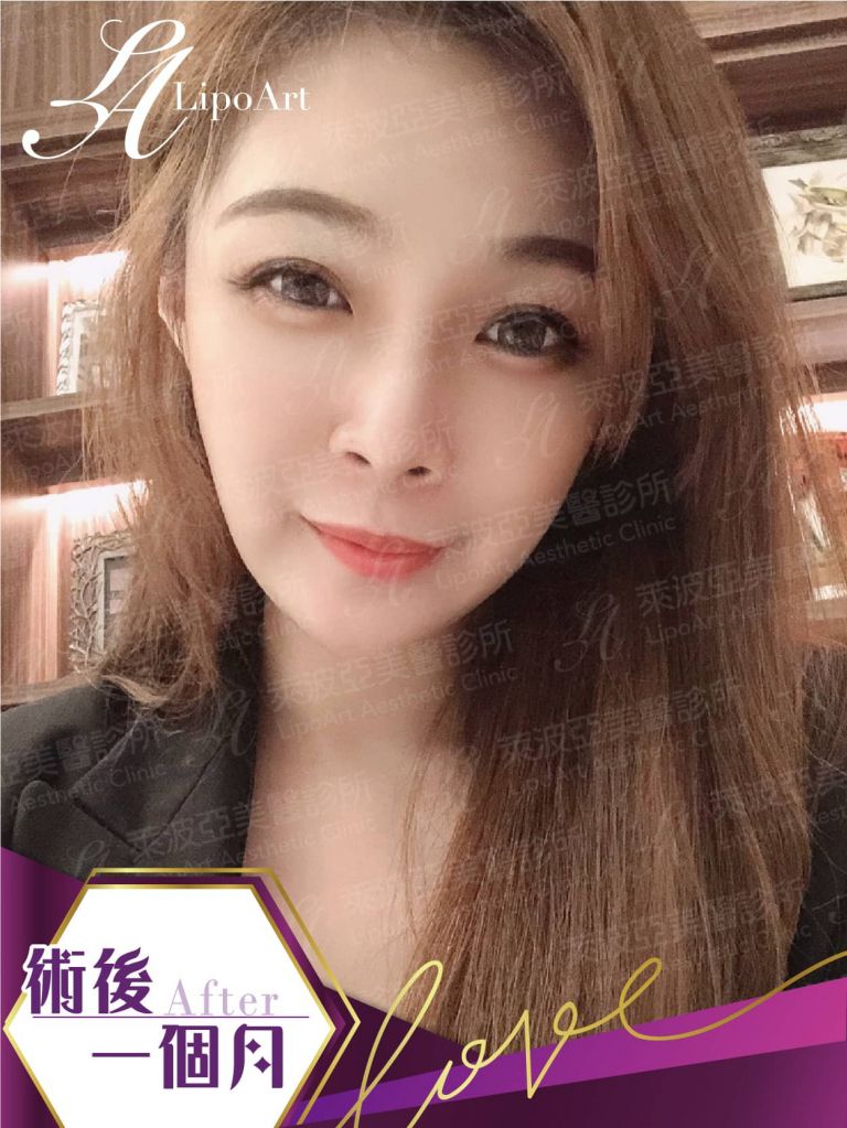 萊波亞