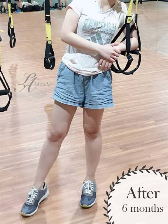 萊波亞