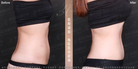 萊波亞