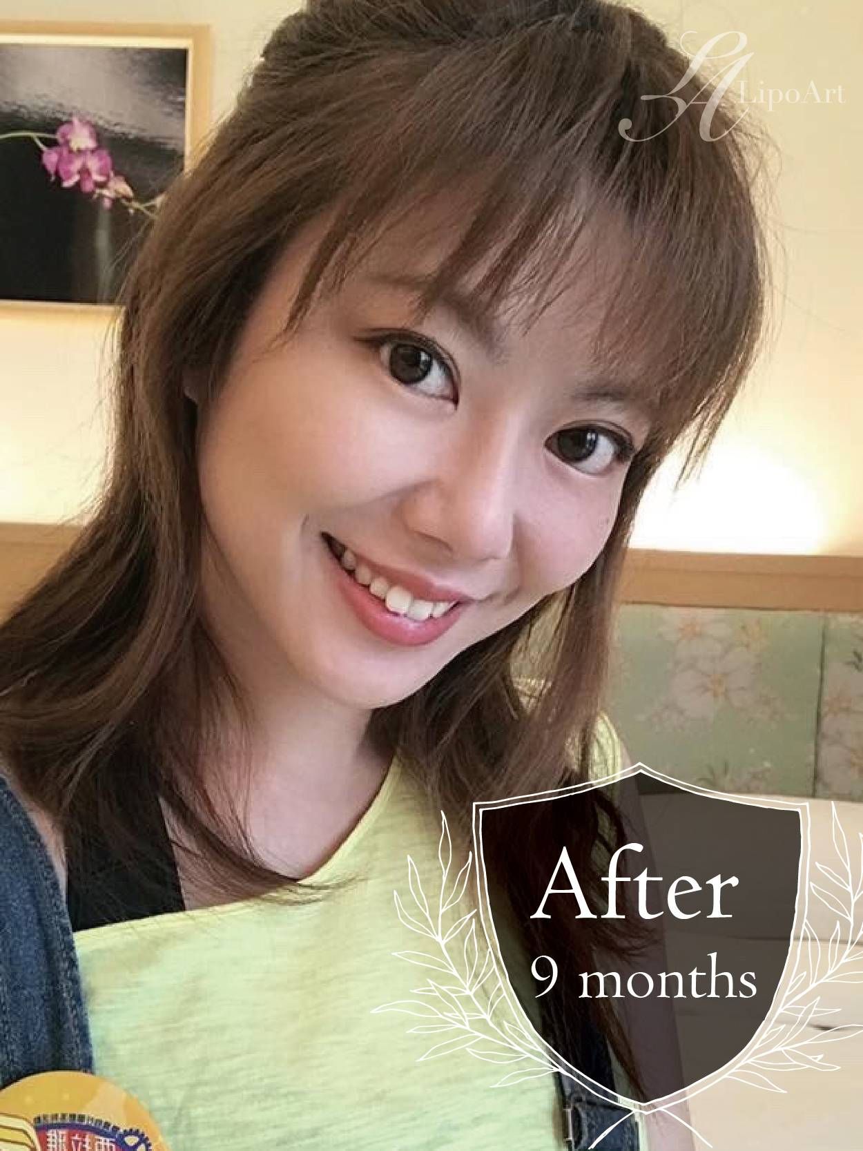 萊波亞