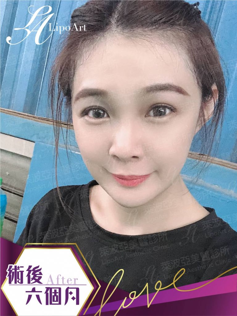 萊波亞
