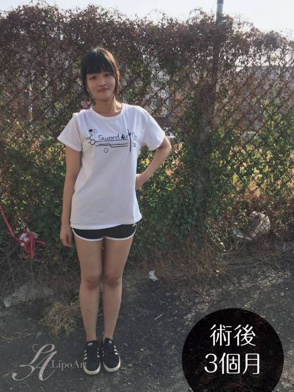 萊波亞