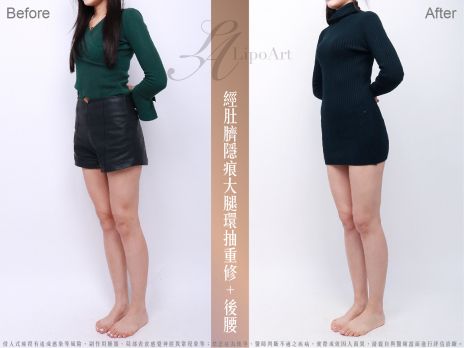 萊波亞 