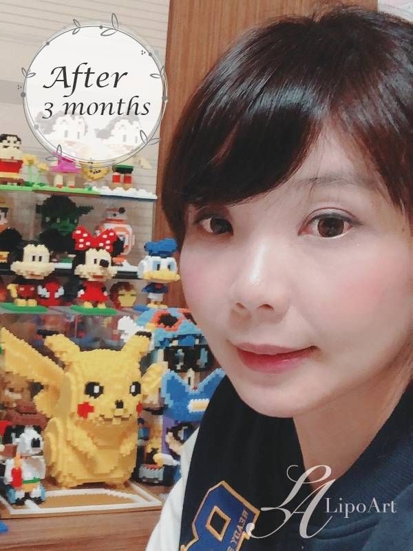 萊波亞