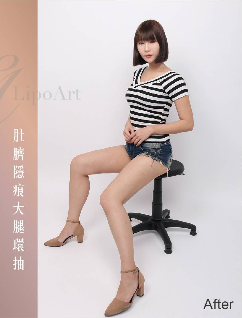 萊波亞 