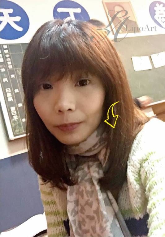 萊波亞