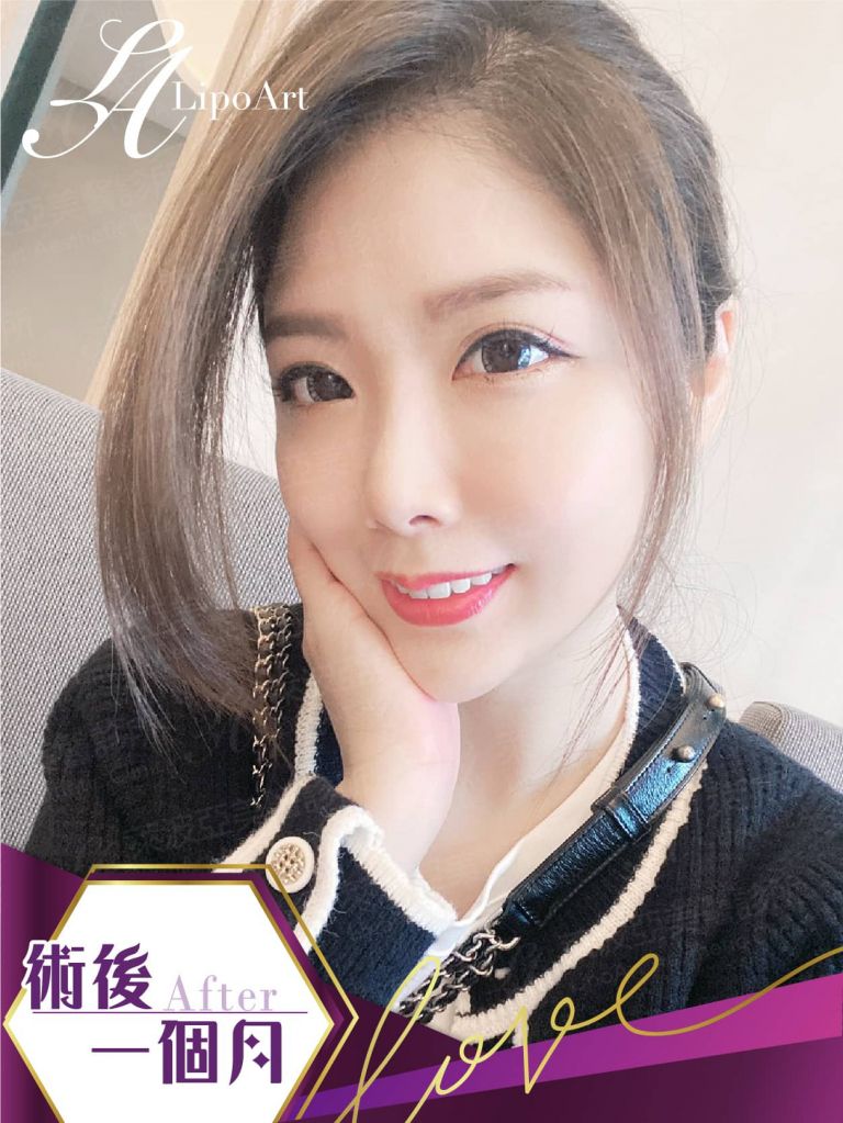 萊波亞