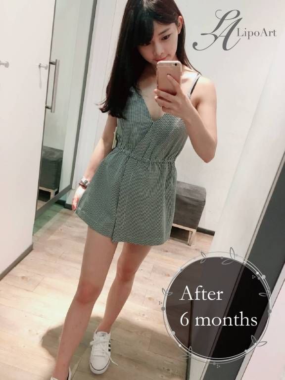 萊波亞