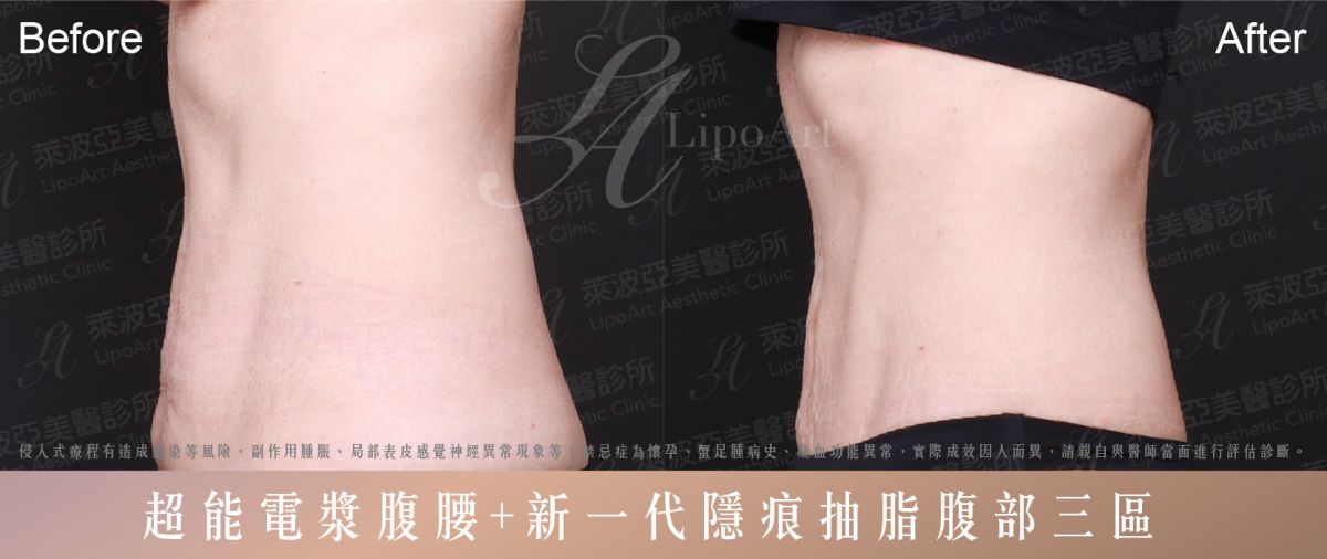 萊波亞