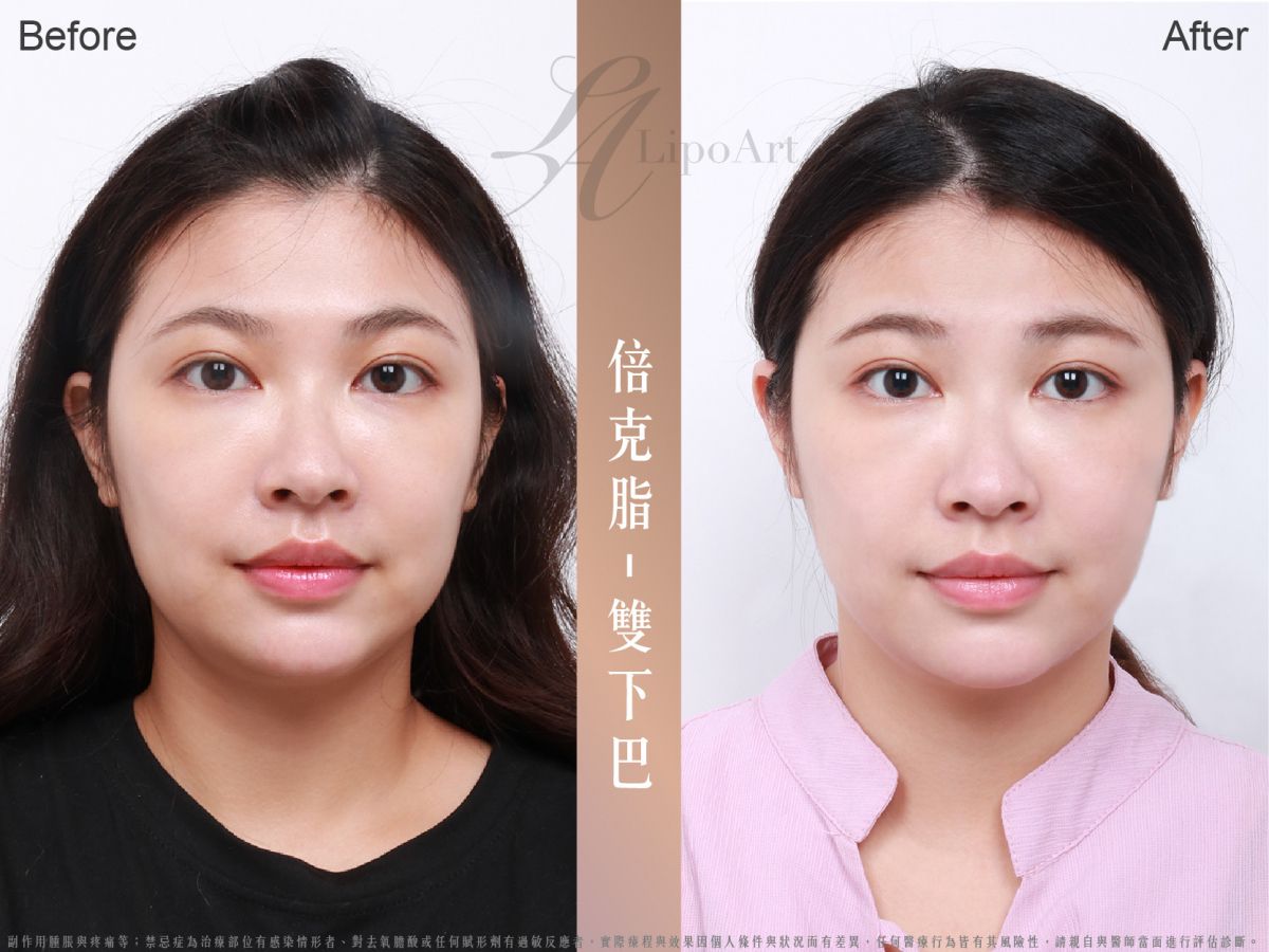 萊波亞