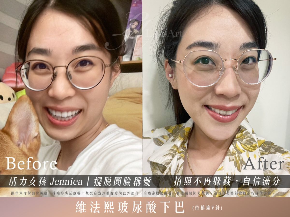萊波亞