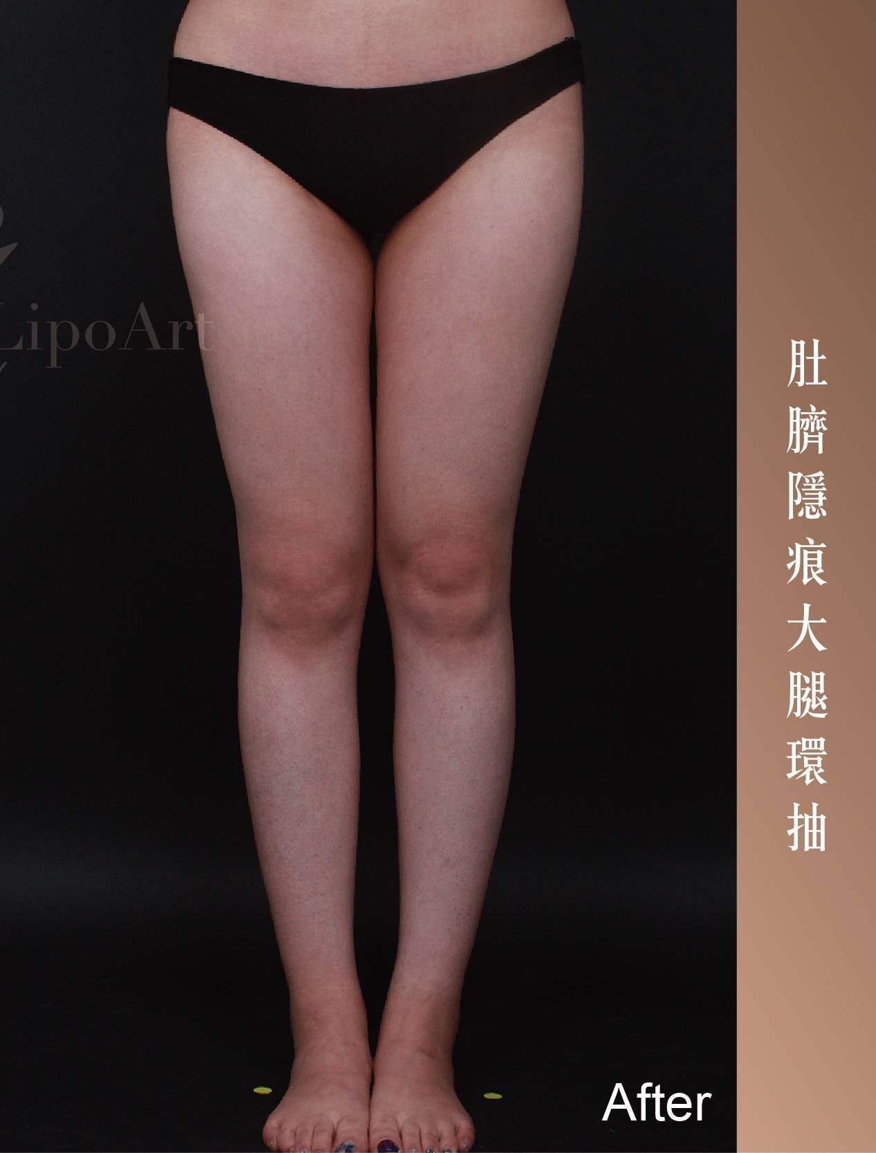 萊波亞 