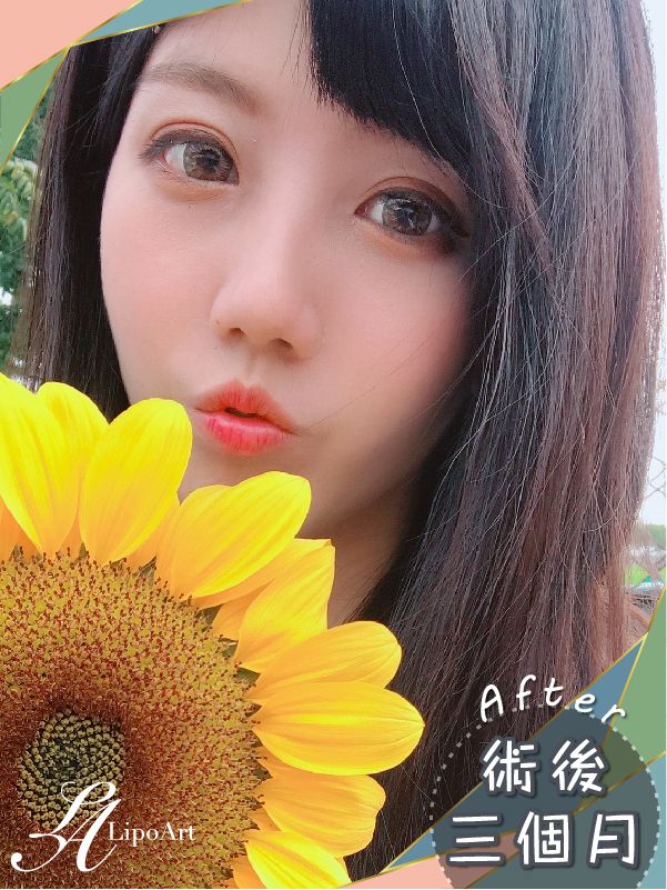 萊波亞