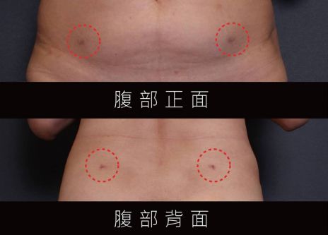 萊波亞