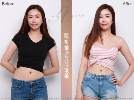 萊波亞 
