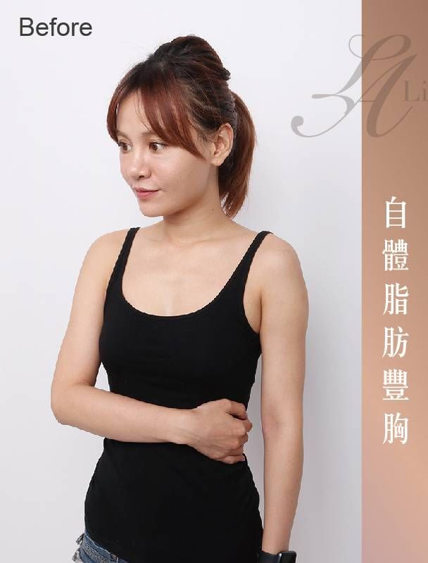 萊波亞 