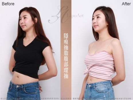 萊波亞 