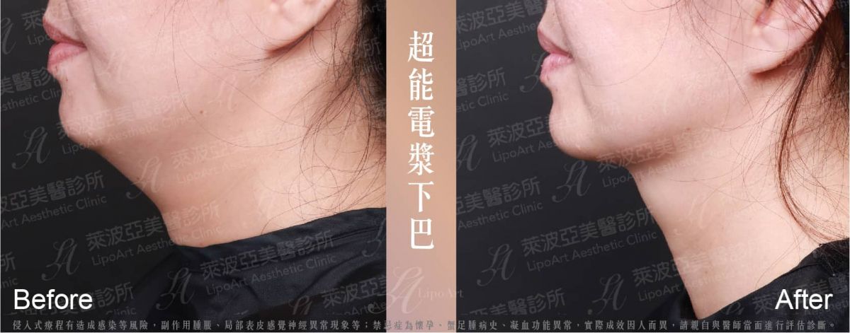 萊波亞