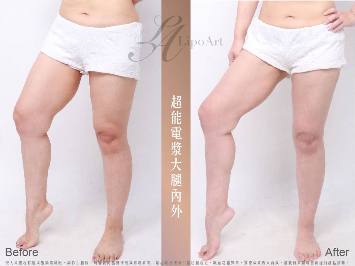 萊波亞
