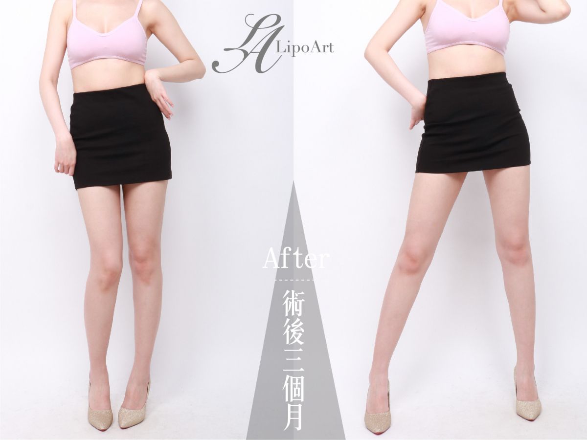 萊波亞