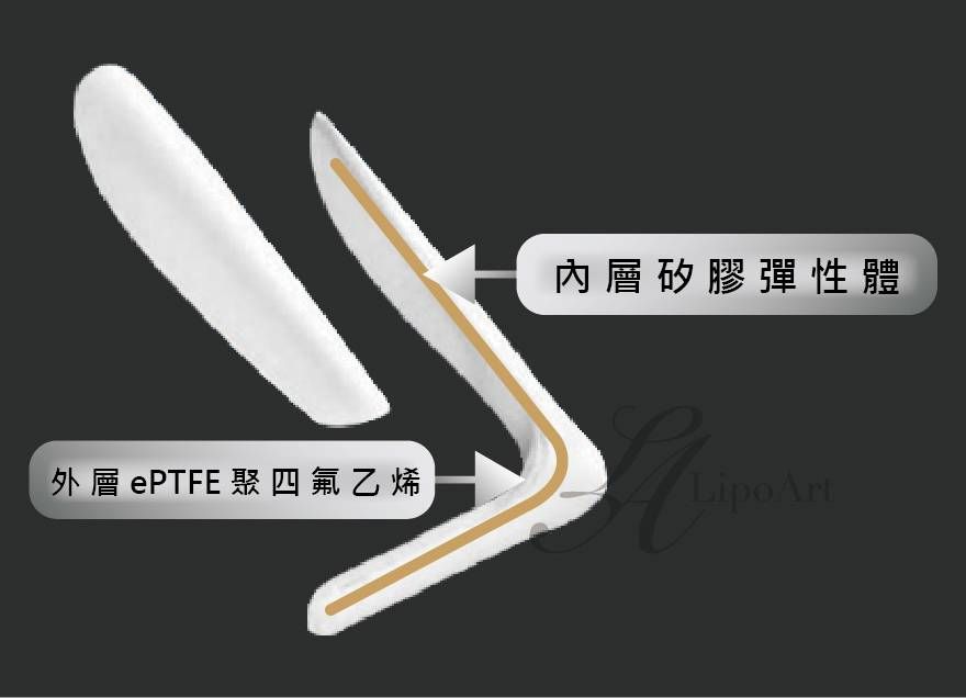 萊波亞