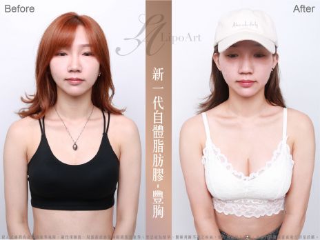 萊波亞 