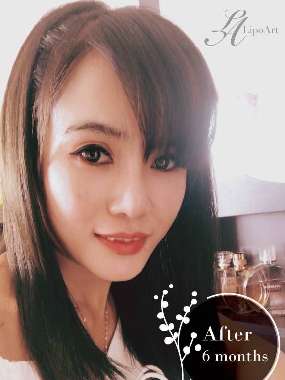 萊波亞