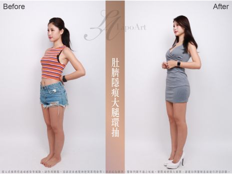 萊波亞 